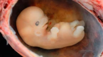 Embriu00f3n humano / Cru00e9dito: lunar caustic - Wikimedia Commons (CC BY 2.0)